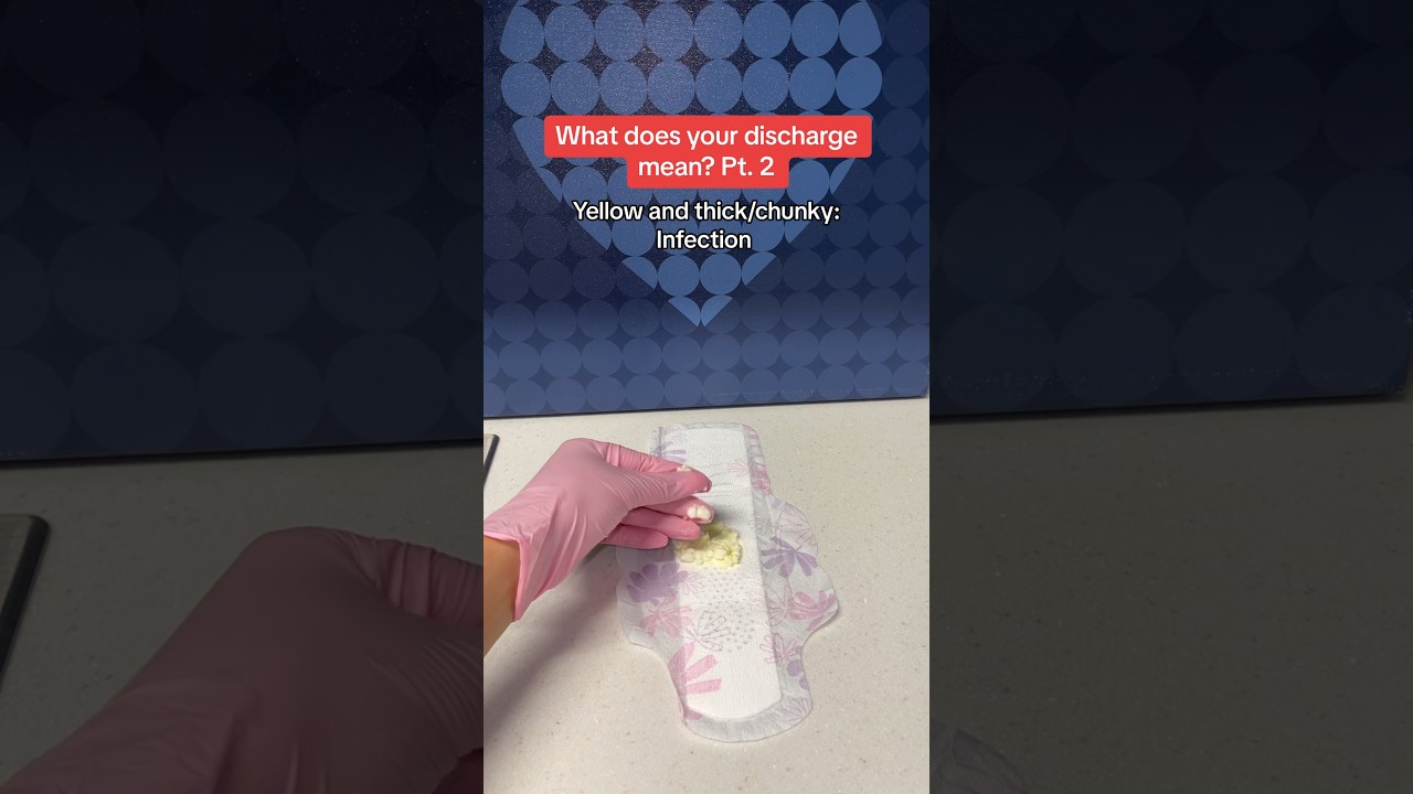 What does your discharge mean? #health #doctor #youtubeshorts #shorts #shortvideo #short #shortsfeed