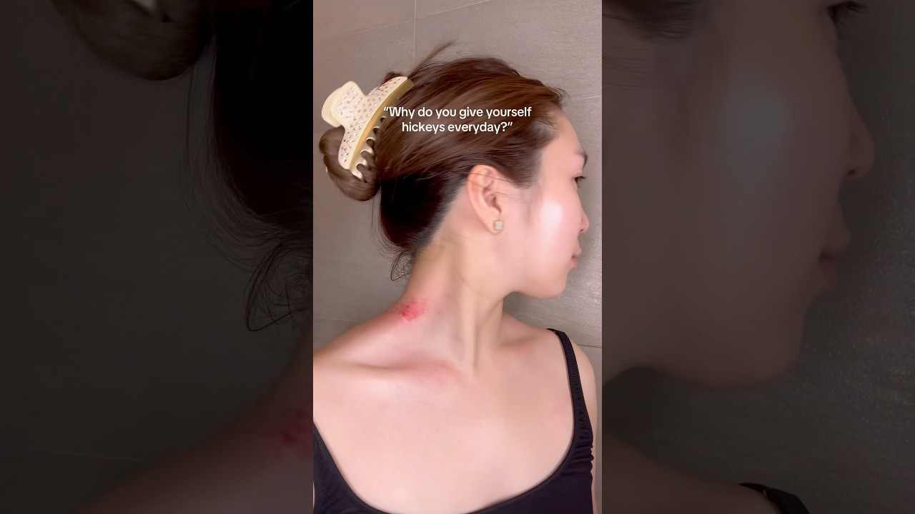 Why do you give yourself hickeys? 😭👀