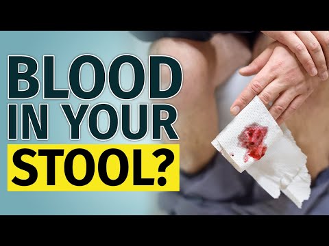 BLOOD IN STOOL | Other Signs You Have to Check