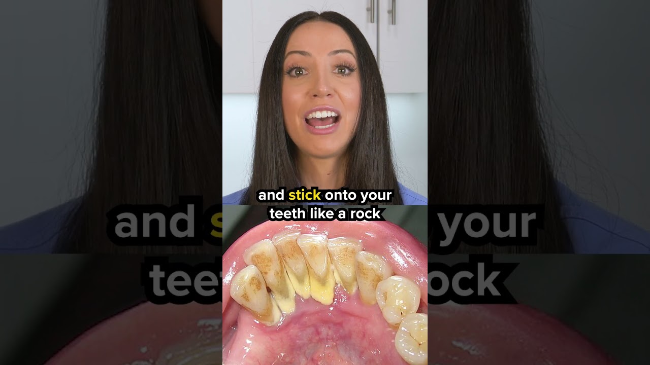 dental tartar vs dental plaque #shorts