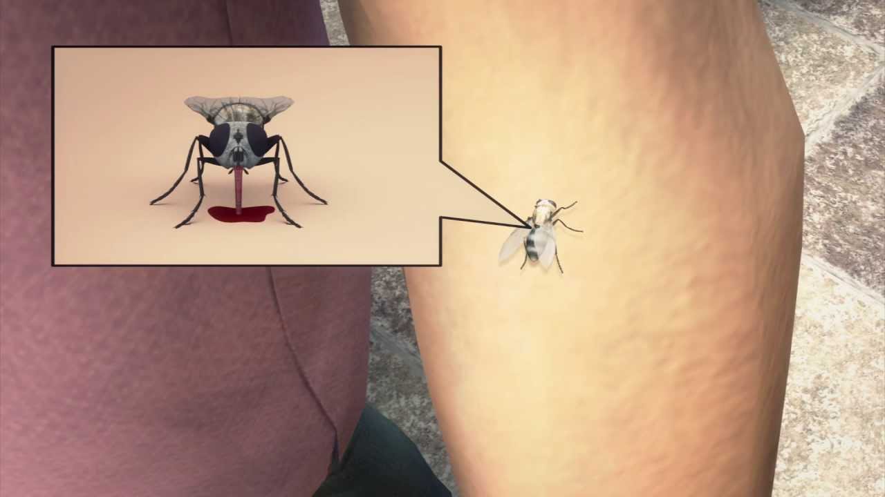 Horsefly bite symptoms