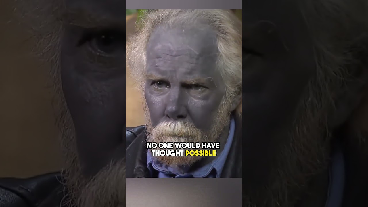 Why Did This Man's Skin Turn Blue?
