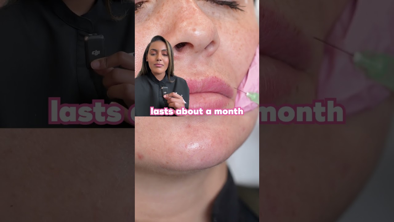 Ask Team LA: Lip Flip vs Lip Filler