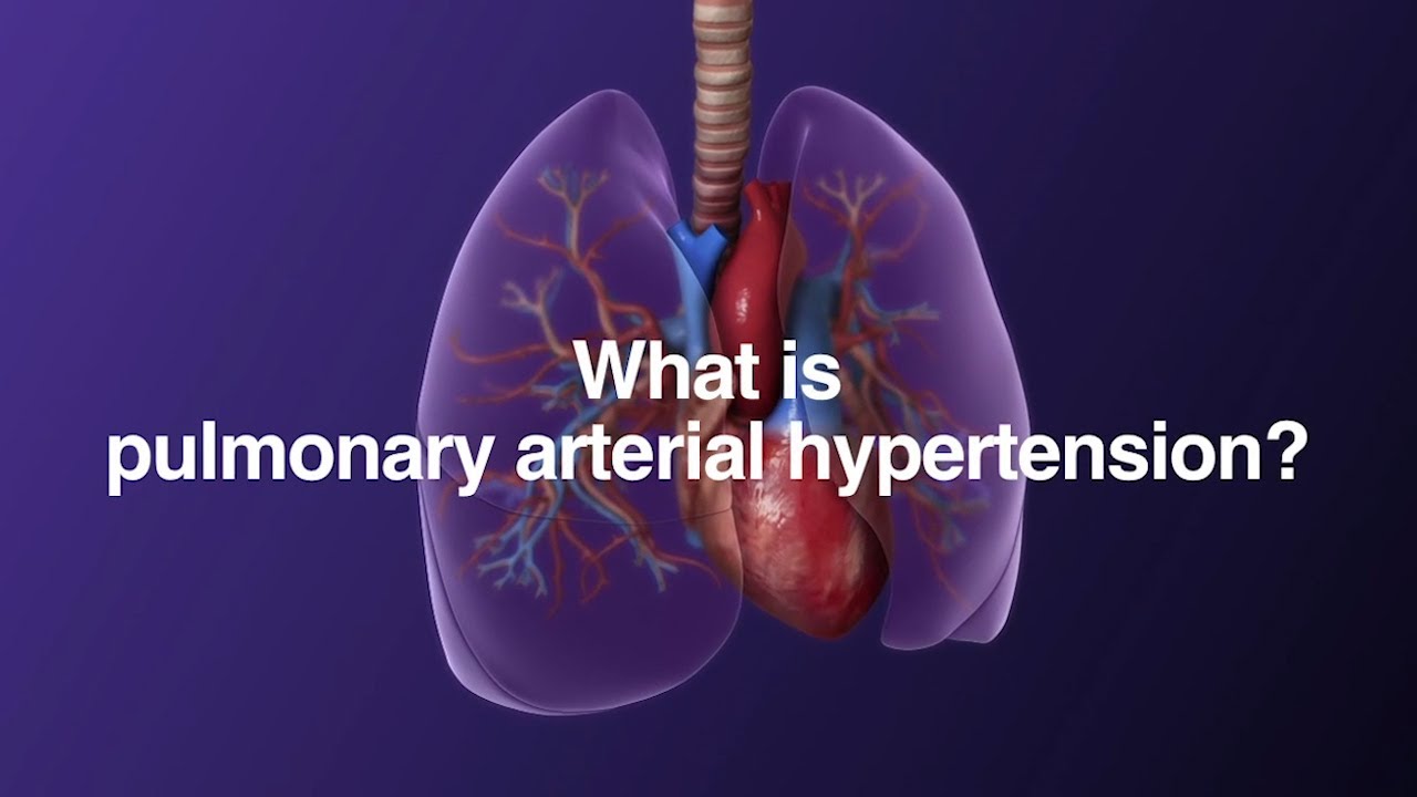 What is PAH?
