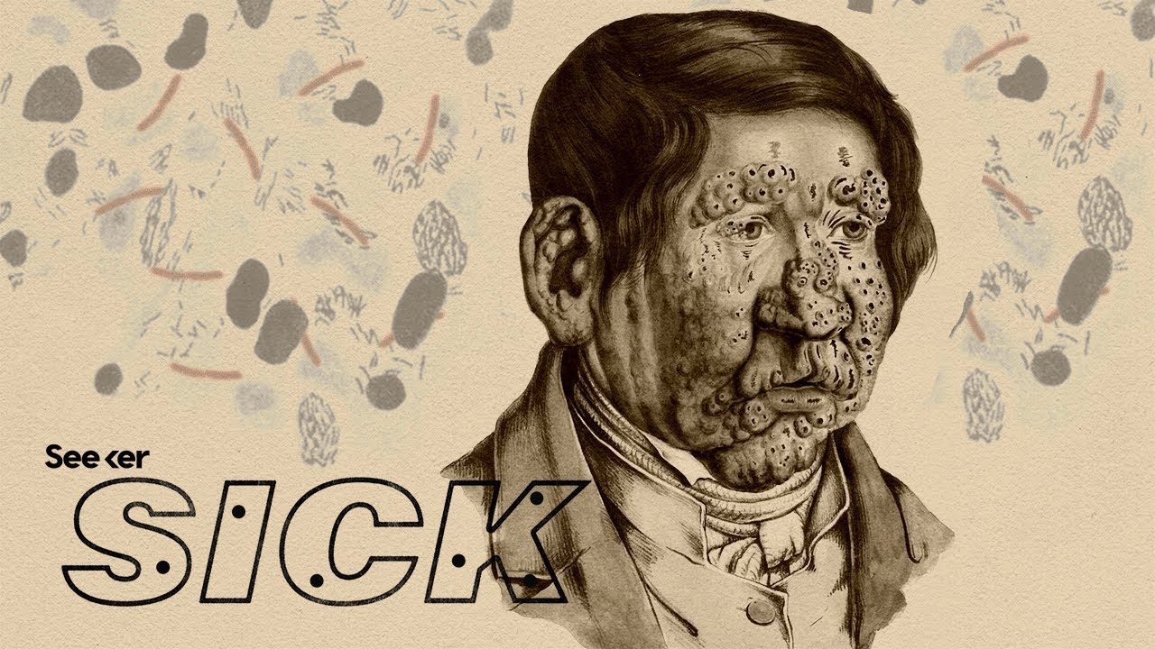 How Does Leprosy Damage the Human Body?