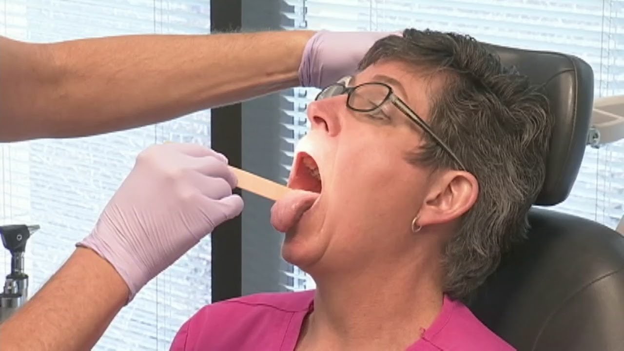 How to spot early symptoms of oral cancer