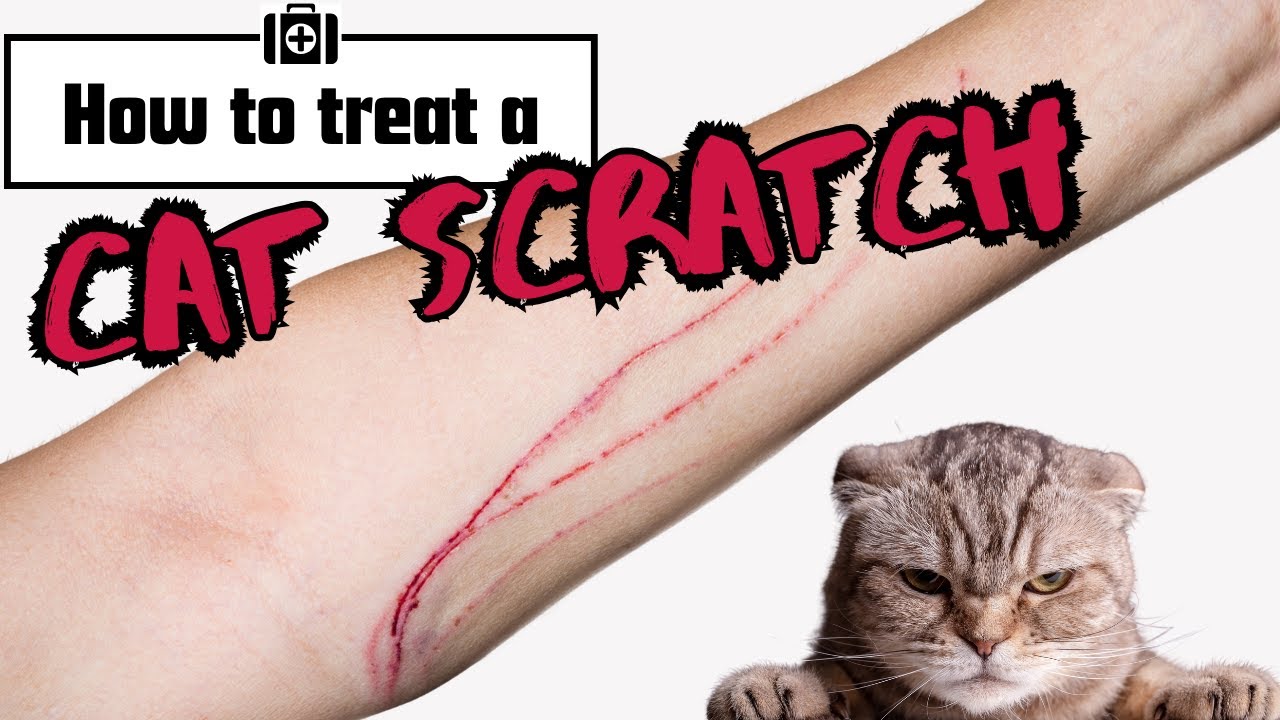 Cat Scratch Care: Essential Tips for Treating Scratches Safely
