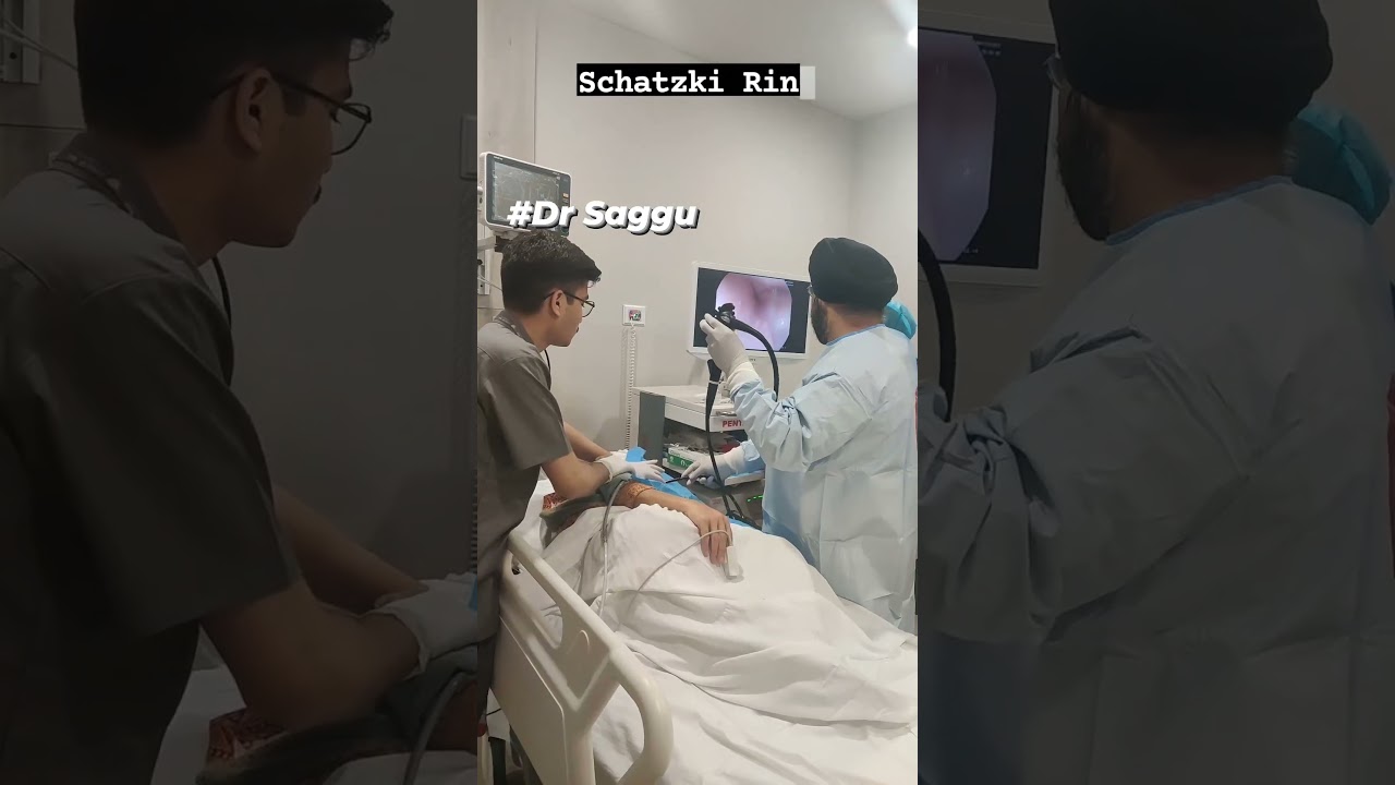 Schatzki Ring Dilatation | Endoscopy | Dr Saggu | Best Bariatric Surgeon in Delhi