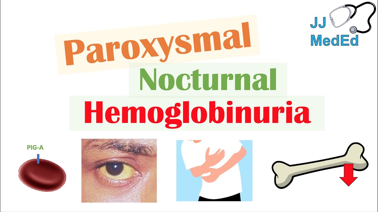 Paroxysmal Nocturnal Hemoglobinuria (PNH) | Causes & Pathogenesis, Symptoms, Diagnosis & Treatment