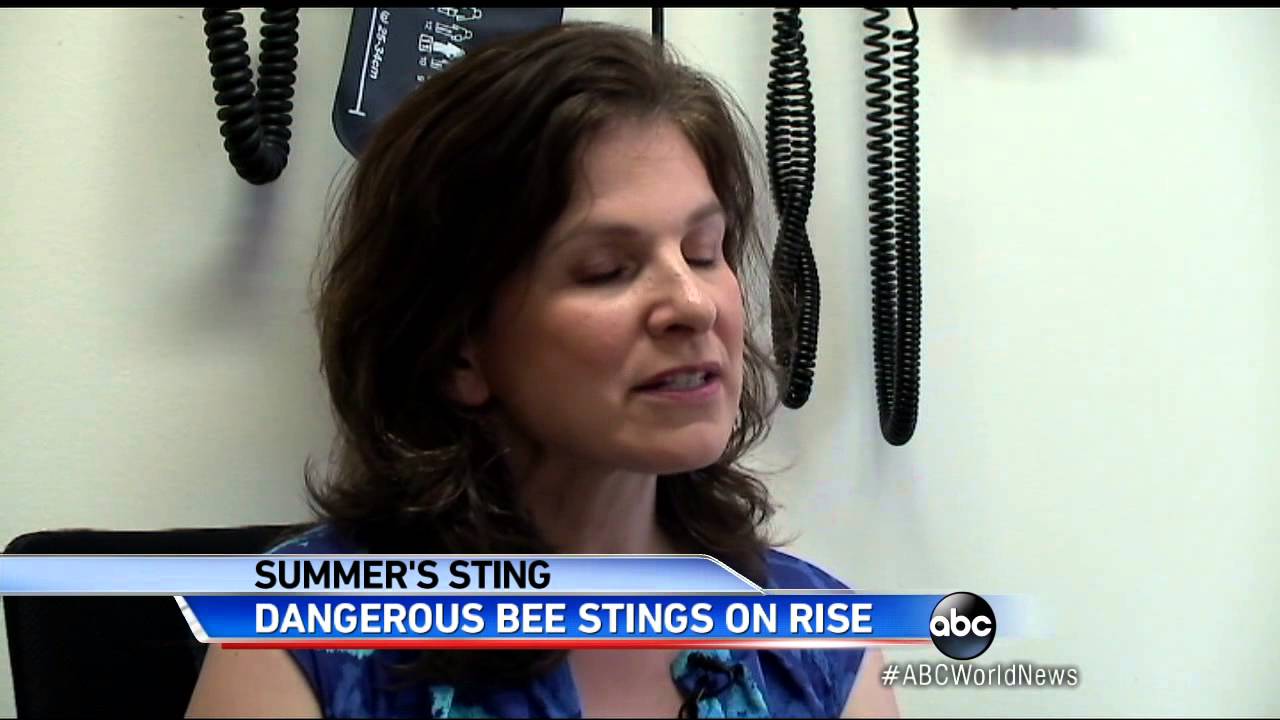 Bee Sting Allergies May Arise at Any Point in Life