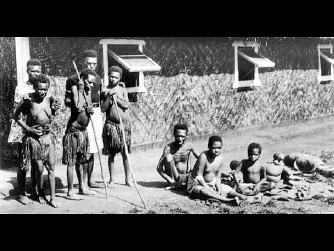 Kuru Disease - A Curious Case in Papua New Guinea (6 Minutes)