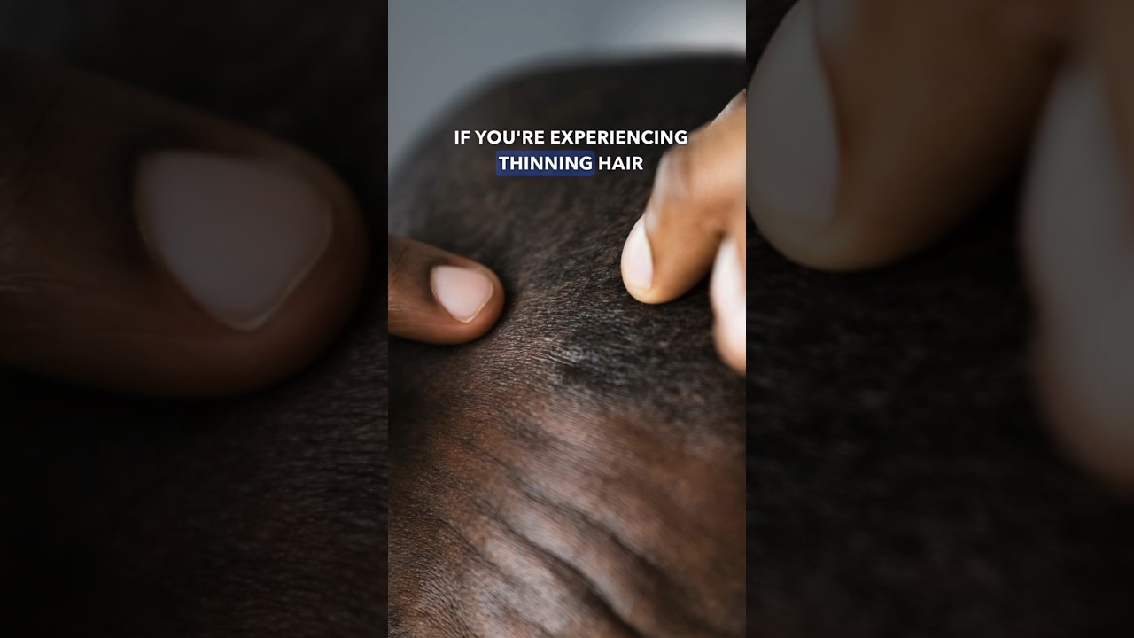 3 Best Solutions for Thinning Hair: Jojoba Oil, Jamaican Black Castor Oil, and Rosemary Oil