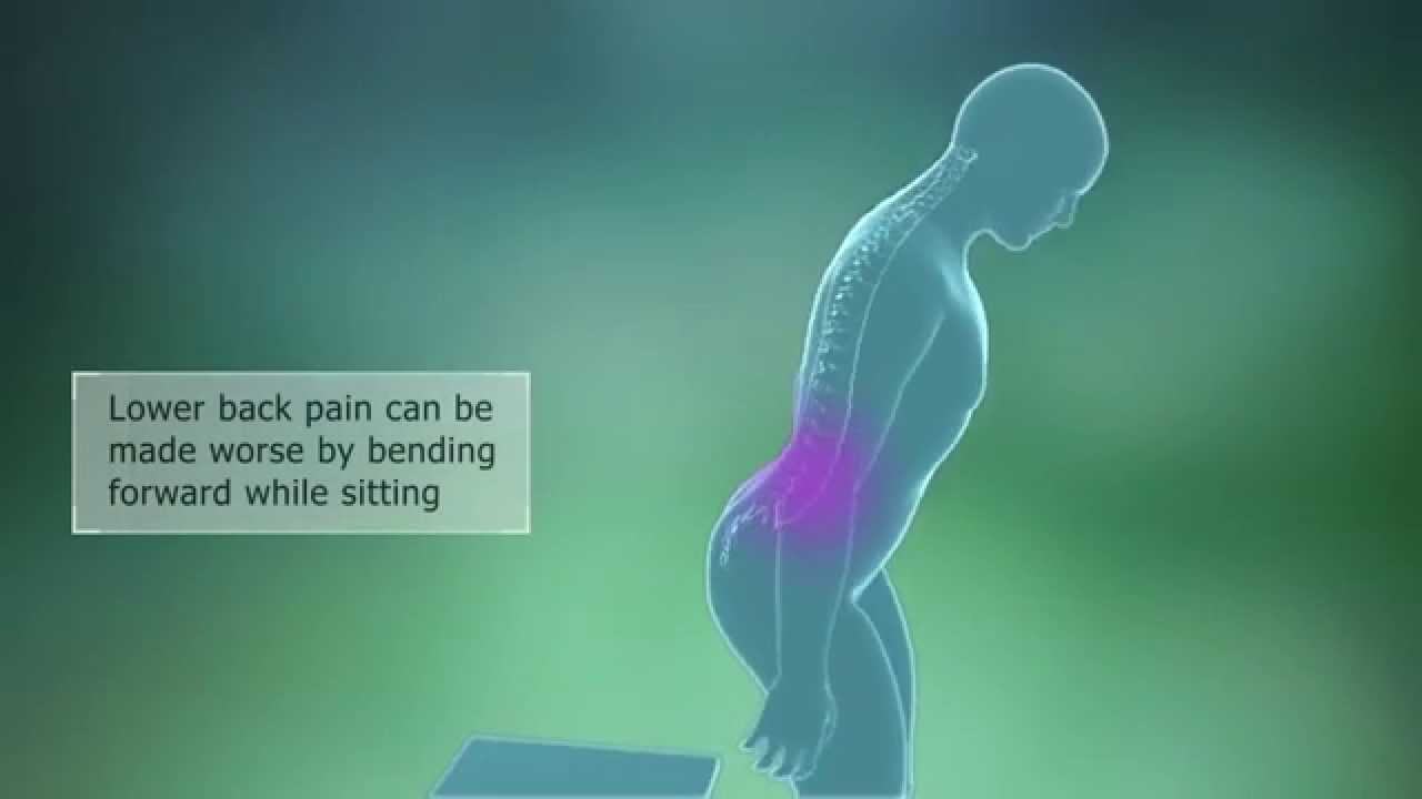 Lumbar Spondylosis Symptoms