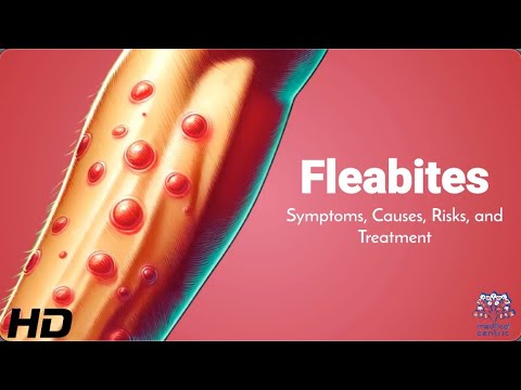 Flea Bite SOS: Immediate Actions for Relief and Recovery