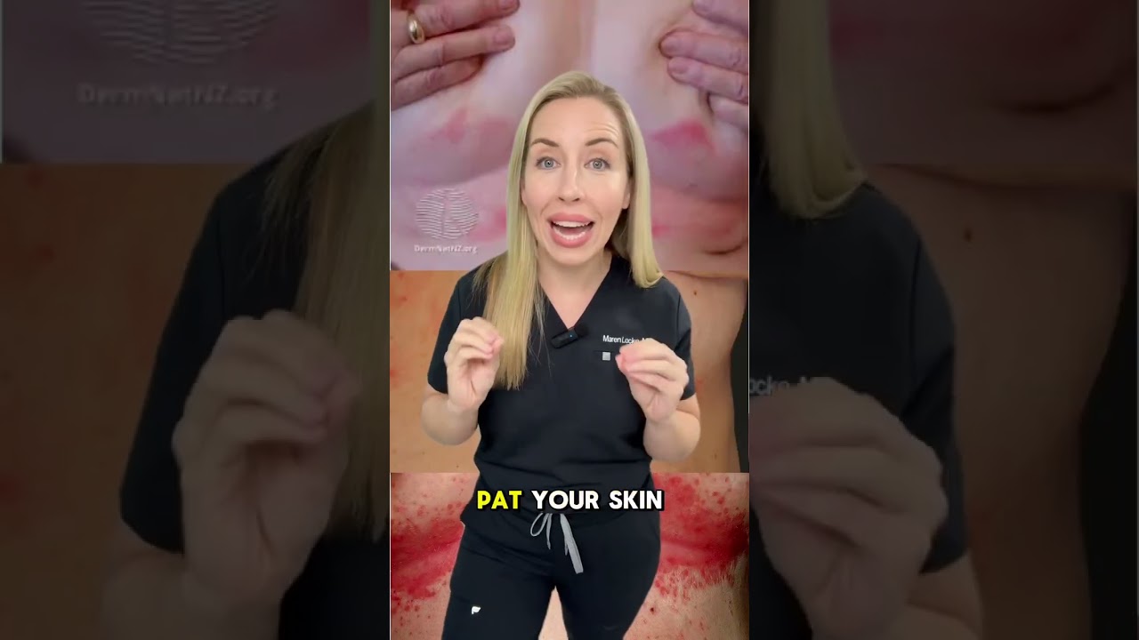 How to fix this red, itchy rash in skin folds called….INTERTRIGO! #dermatologist #skincare