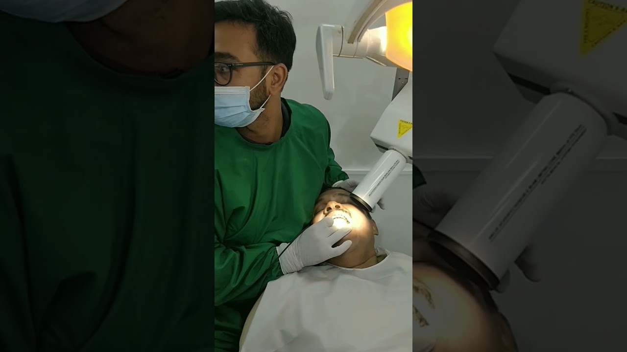 IOPAR 26 #MOLAR X RAY