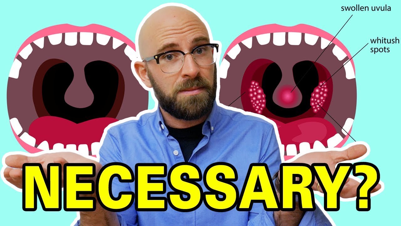 What Do Tonsils Actually Do and Why are We Constantly Removing Them