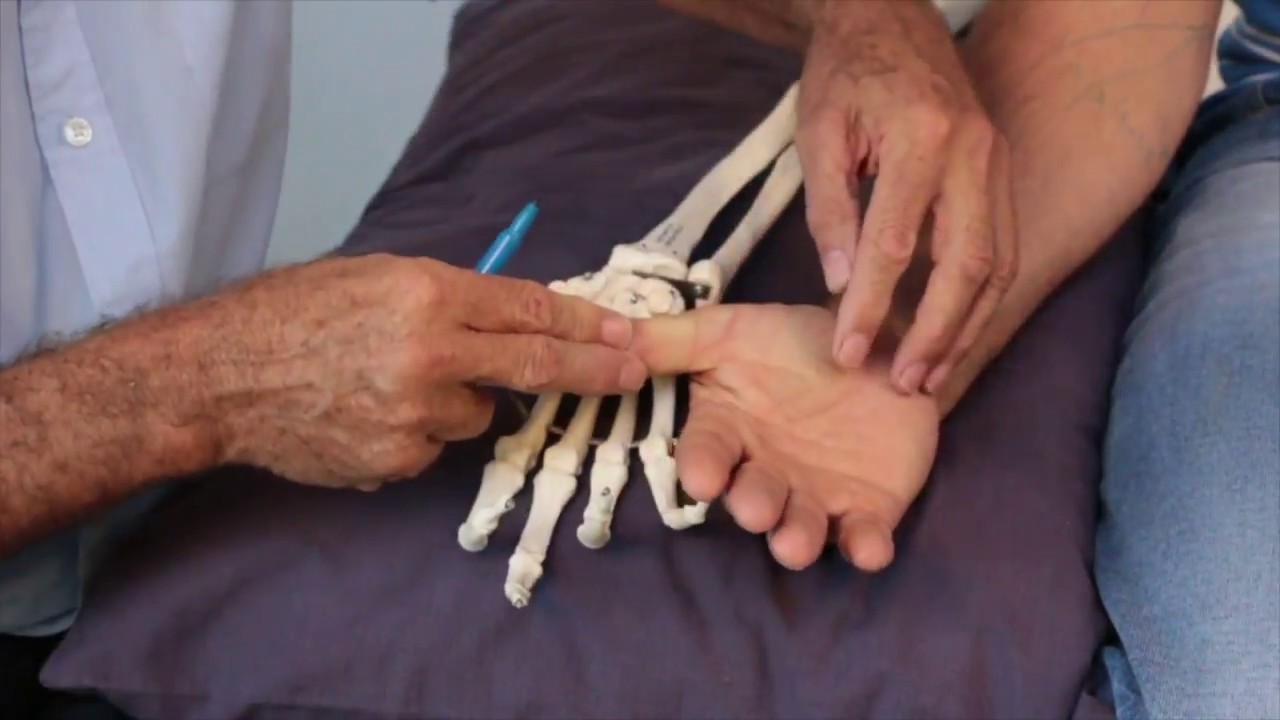 Treating Trigger Points - Thenar Eminence