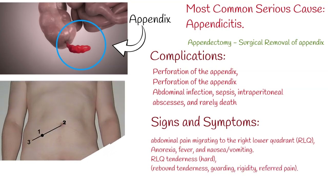 Pain in Lower Right Abdomen - causes and symptoms