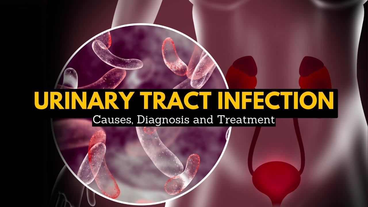Urinary Tract Infection, Causes, Signs and Symptoms, Diagnosis and Treatment.