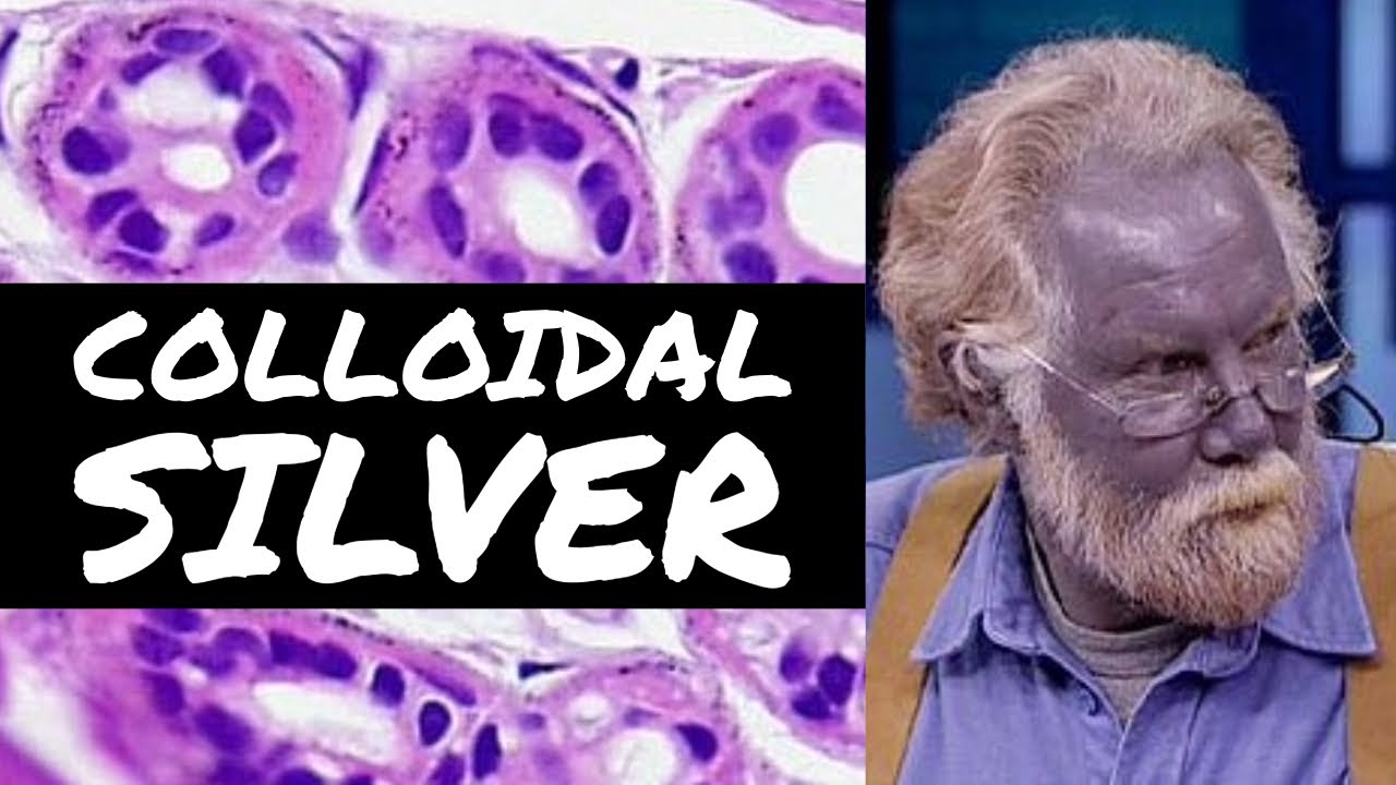 Argyria (blue skin from colloidal silver) under the microscope (pathology dermpath dermatology)