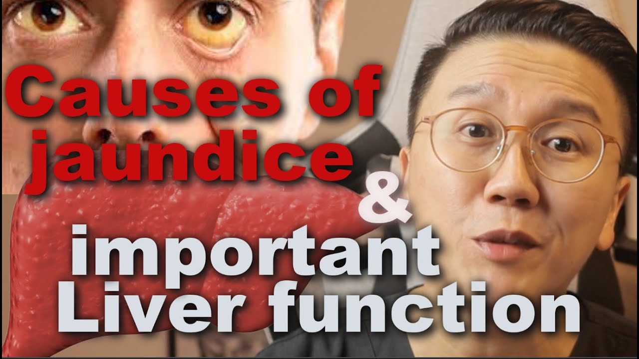 What Causes Yellowing of the Eyes? Jaundice and Liver Function Explained ( part 1 )