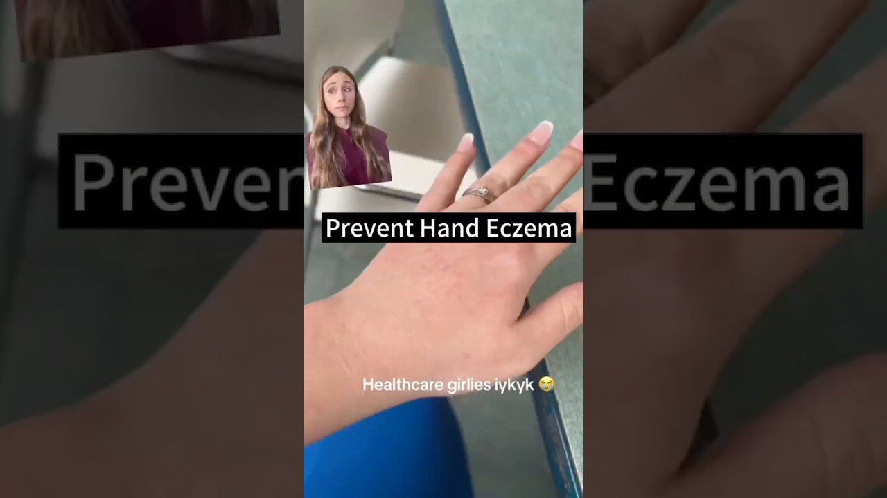 Heal & Prevent Hand Eczema #dermatologist