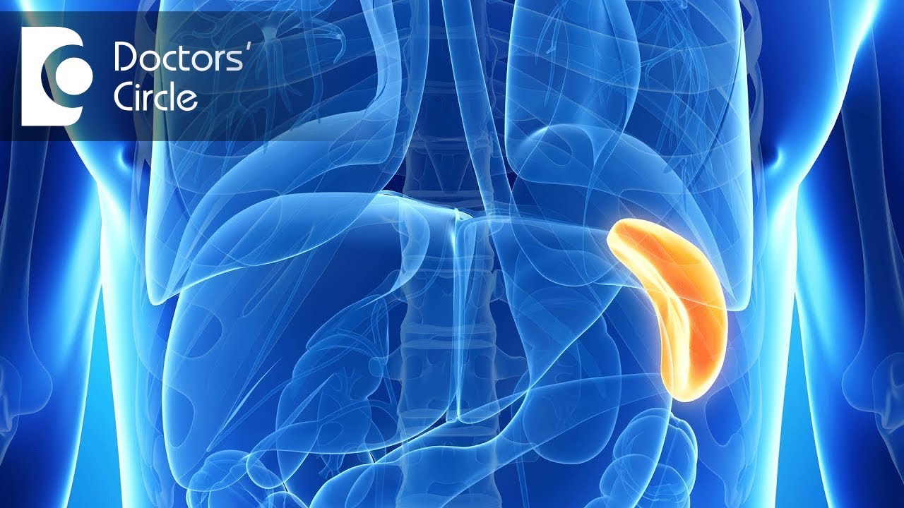What are the after effects of Splenectomy? - Dr. Sathish N
