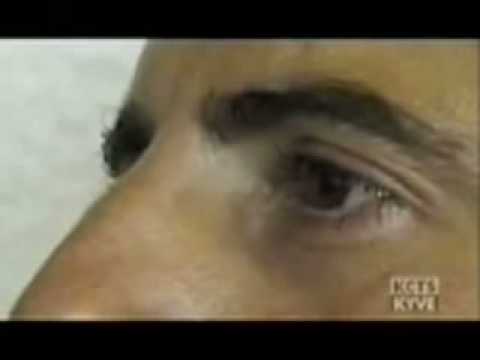 Capgras' delusion patient