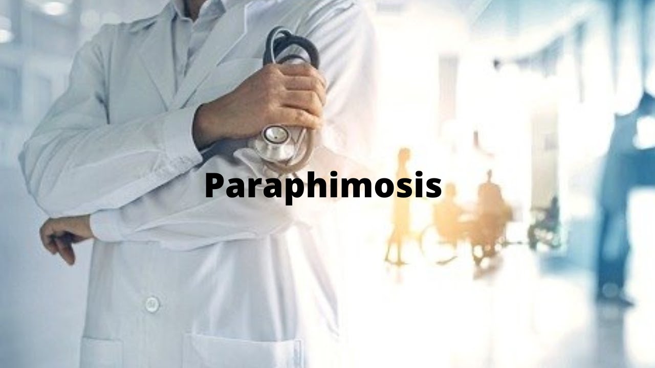 S8E6 Paraphimosis is a serious medical emergency in men