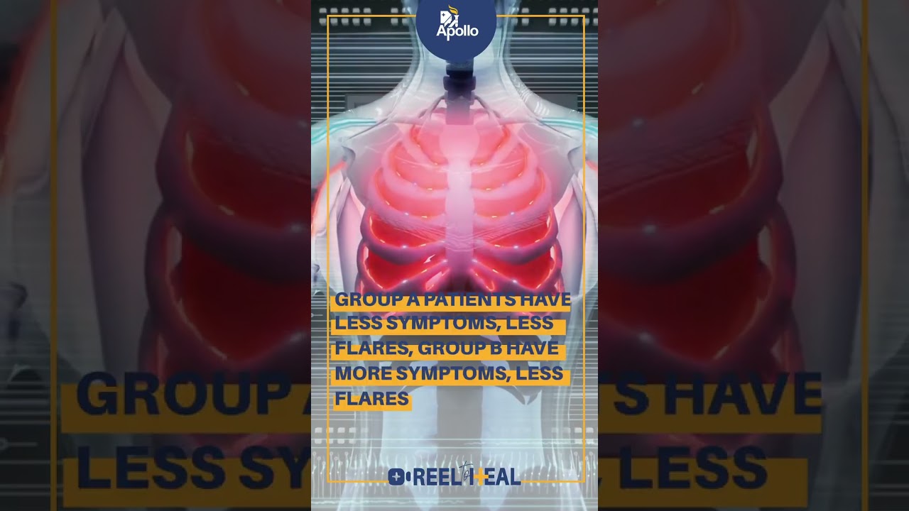 The Four Stages of COPD | Dr. Srikar Darisetty, Pulmonologist | Apollo Hospitals #shorts