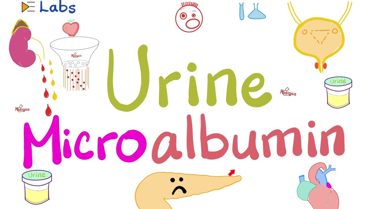 Microalbumin in the Urine (Microalbuminuria) - Diabetes Mellitus & Kidney Disease - Nephrology Labs