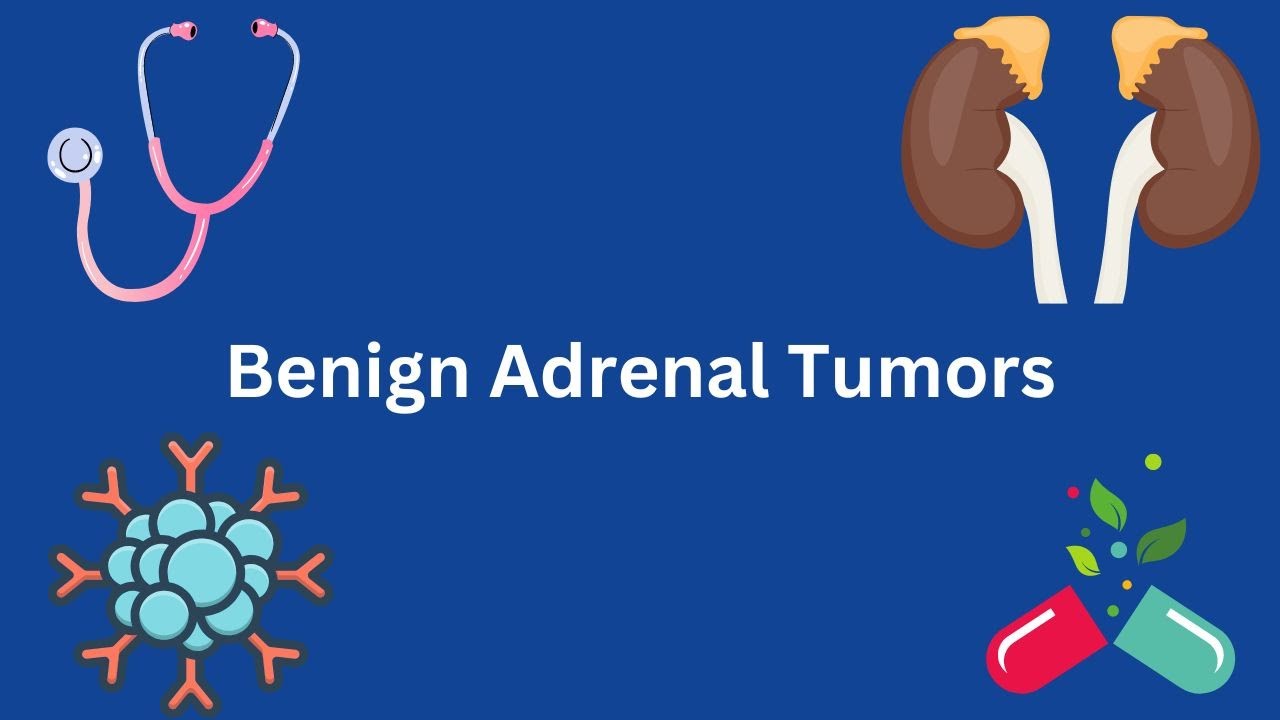 Benign adrenal tumors: What You Need To Know