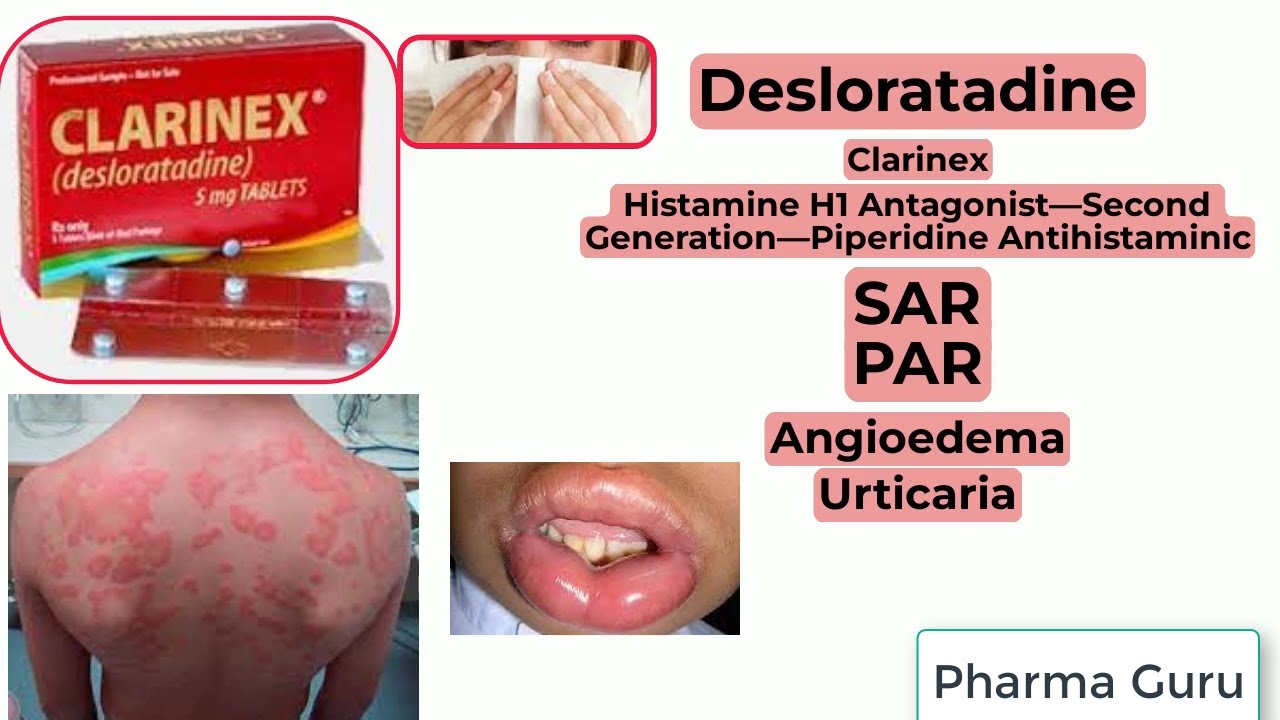 Desloratadine - Clarinex in a nutshell.