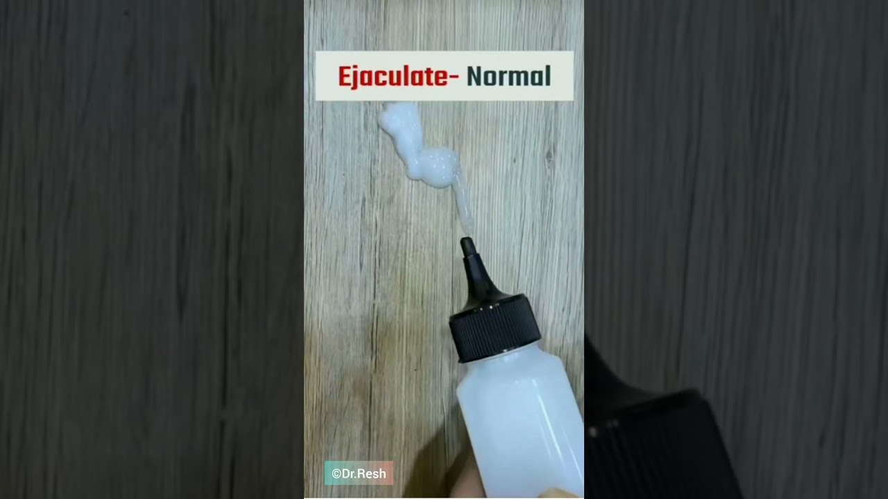 MALE DISCHARGE. #Male discharge #Ejaculation #Semen #shorts