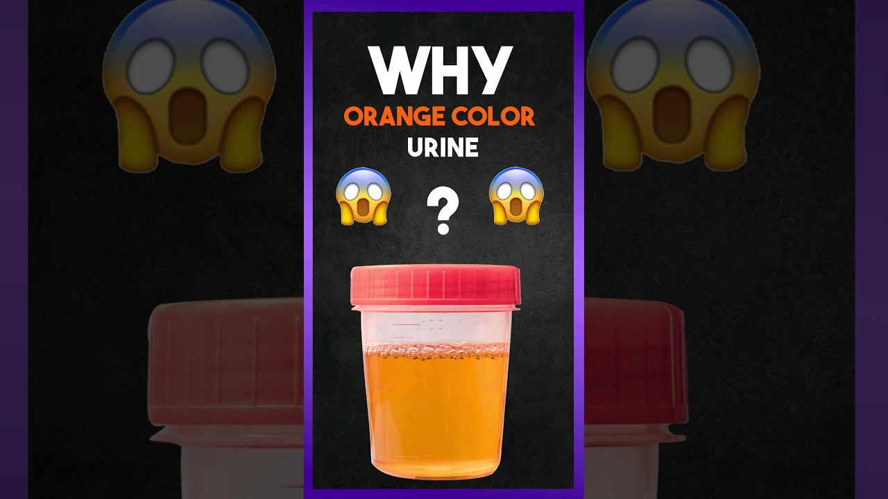 Why "Orange Colour " Urine ?