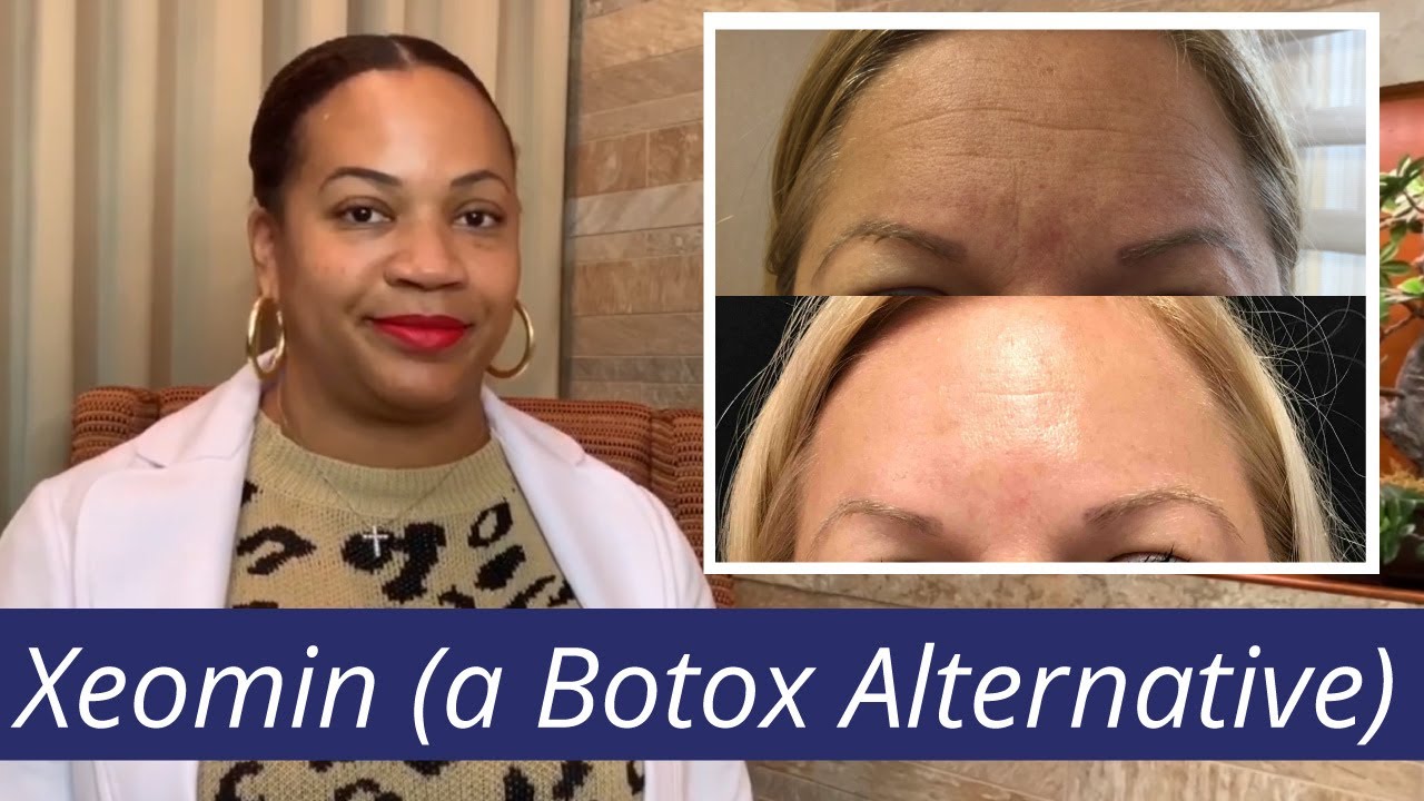Xeomin: A #BotoxAlternative You Should Know About