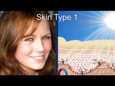 What is my skin type? (the six Fitzpatrick skin types)