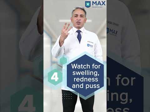 5 tips to treat Skin Ulcers at home | Max Hospital