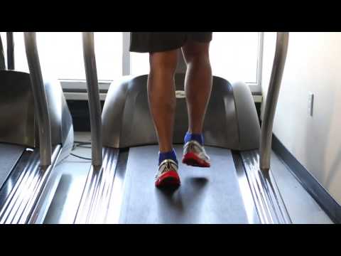 How Many Miles to Walk to Lose Weight on a Treadmill?