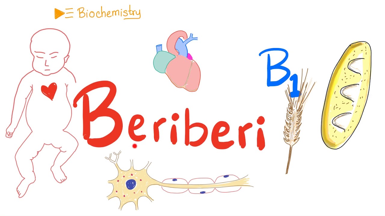 Beriberi - Vitamin B1 Deficiency - Thiamine Deficiency - Diet and Nutrition
