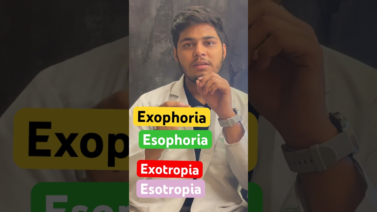 What is Exotropia , Esotropia , Exophoria, Esophoria #squint #exotropia