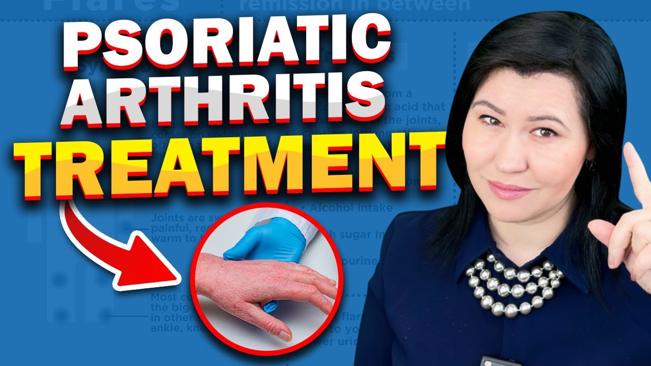 Best Psoriatic Arthritis Treatments