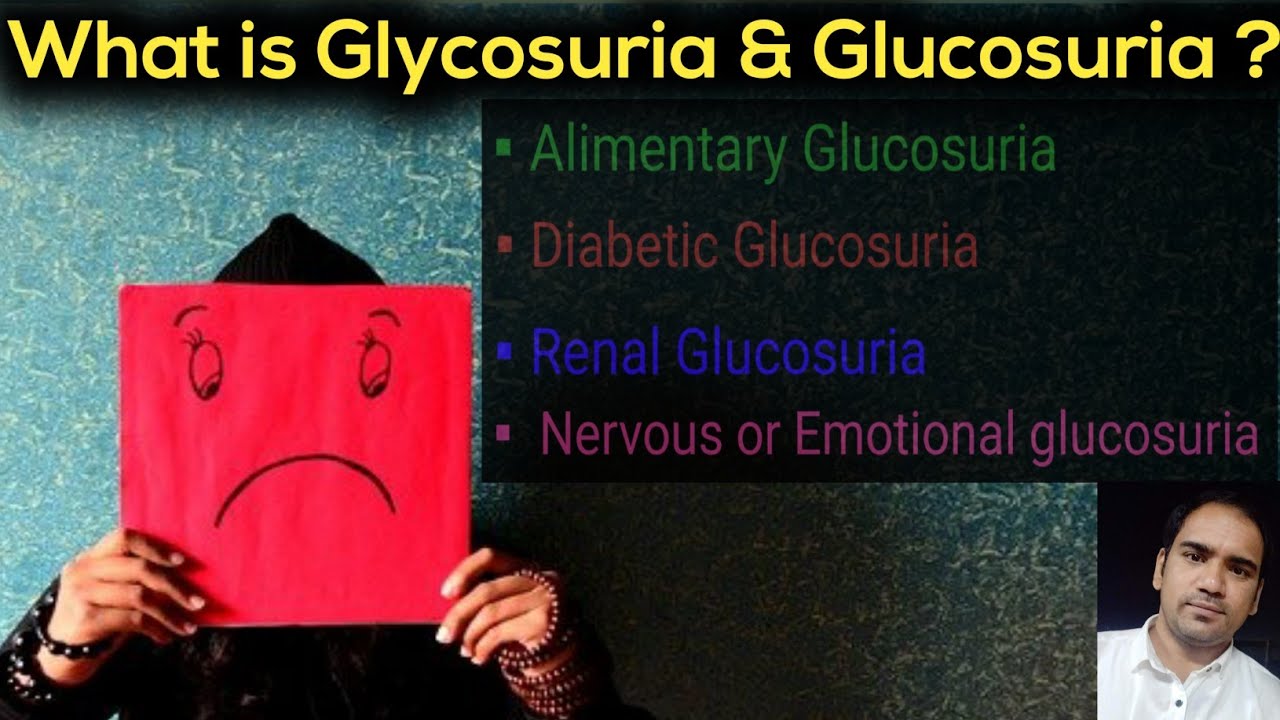 What is Glycosuria & Glucosuria ? Different Types of Glucosuria (Alimentary,Renal,Diabetic&Nervous)