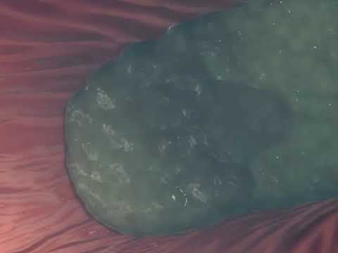Rugae (stomach Folds)