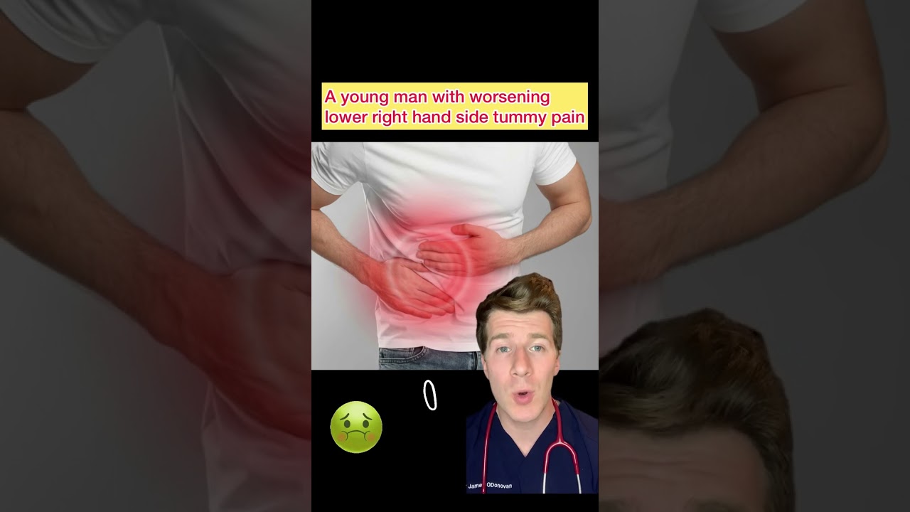 A man with right sided lower abdominal pain…what’s the diagnosis? (PART 1) #shorts #medical #doctor