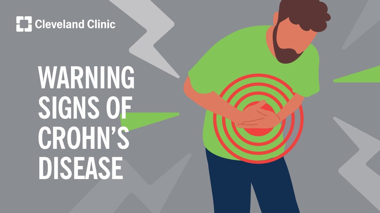 Warning Signs of Crohn’s Disease