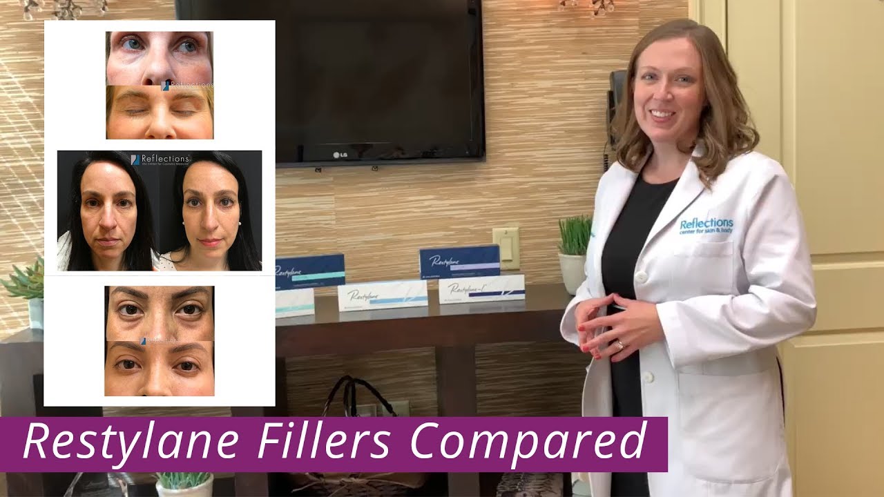 Restylane Fillers Compared & Contrasted [ #Restylane, #Refyne, #Defyne, #Lyft, #Silk ]