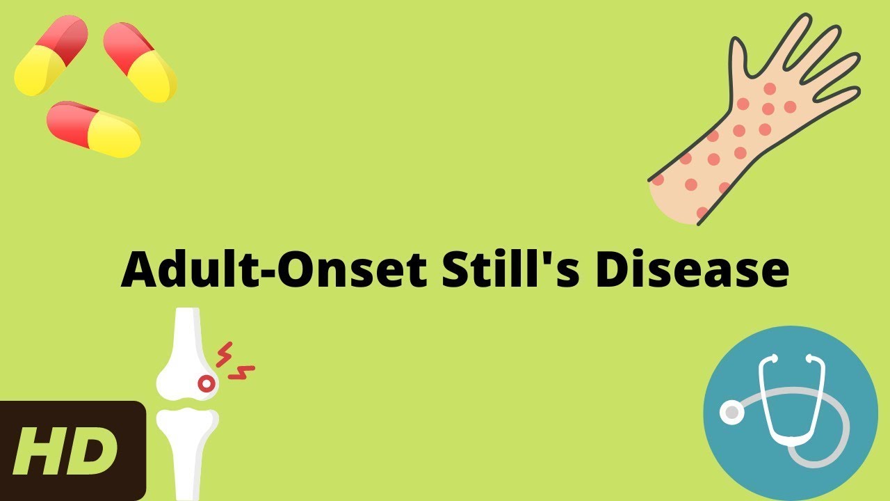 Adult-Onset Still's Disease: Causes, Symptoms, And Treatment.