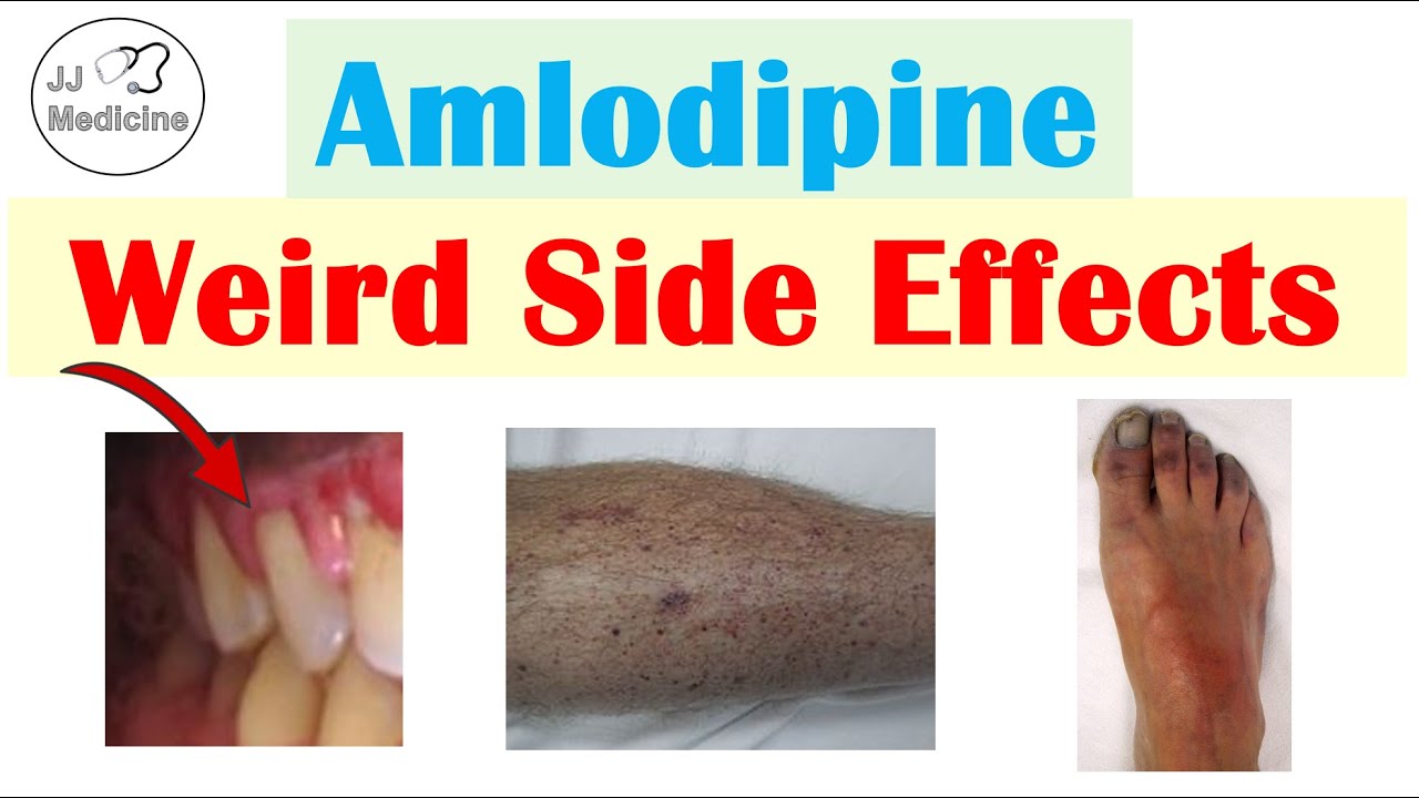 Amlodipine Weird Side Effects (Skin, Gastrointestinal, Psychological)